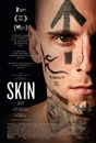 SKIN1 - Skin